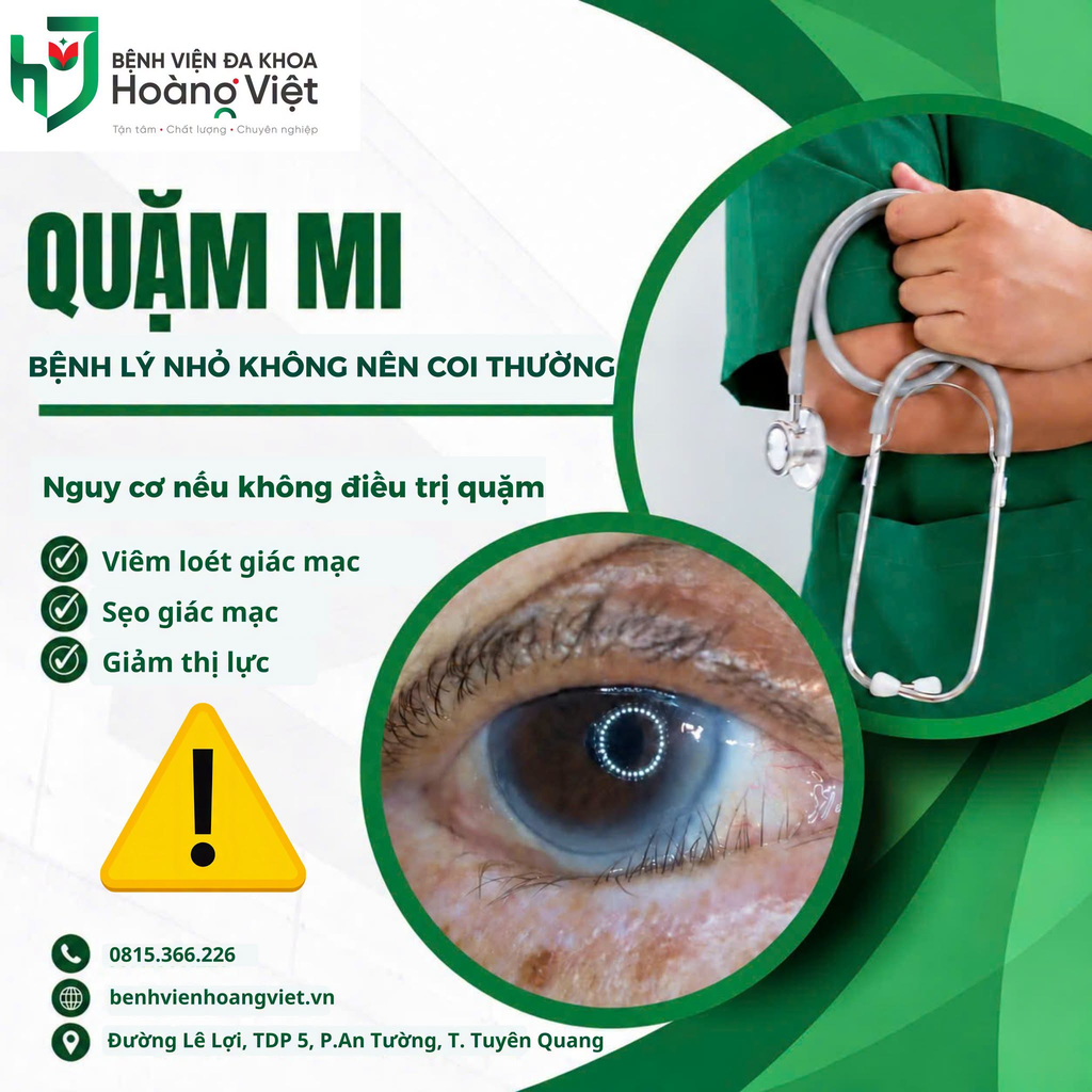 Chuẩn bị chào đời